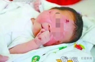 厦门车祸“奇迹宝宝”近况：在泸州老家生活，亲属因赔偿款反目